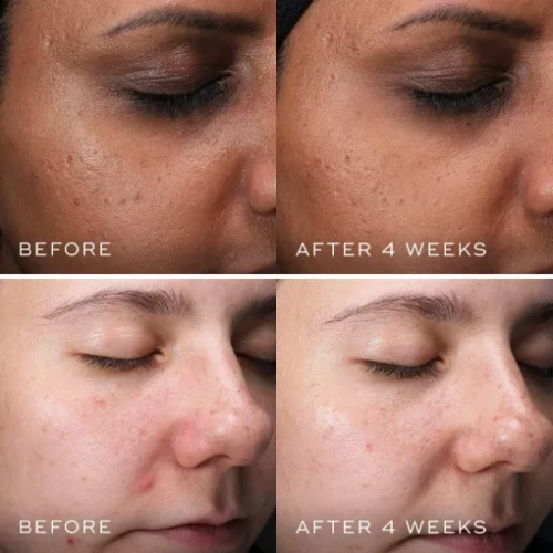 Medik8 Clarity Peptides 30ml  Очищуючі пептиди, з ніацинамідом 10%